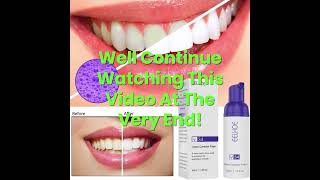 EELHOE V34 Foaming Whitening Toothpaste Cleans Tartar Yellow Stains Fresh Breath Whiten Teeth [upl. by Pokorny]