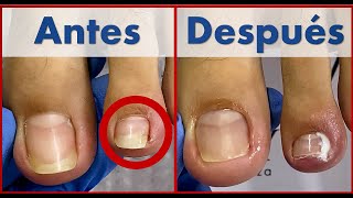 pedicura profunda  que uso para desinfectar y cicatrizar trabajo en cliente  Extreme pedicure [upl. by Aynotan]