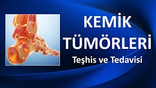 KEMİK TÜMÖRLERİ TEŞHİS VE TEDAVİSİ [upl. by Emmerich]