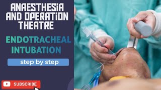 endotracheal intubation [upl. by Brittnee38]