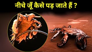 नीचे के बालों में जूँ कैसे पड़ जाते हैं  pubic lice [upl. by Anon]