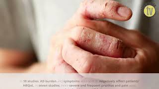 Pruritus pain are main drivers of AD impact and HRQoL according to study [upl. by Nivrad]