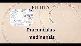 Ришта Dracunculus medinensis  Морфология Жизненный Цикл Диагностика Лечение Профилактика [upl. by Suoicerp737]