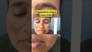 Pigmanorm cream Uses in urduHindi  Pigmanorm whitening cream  pigmanorm cream  Dr Nadeem [upl. by Ashley]