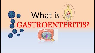 What is Gastroenteritis  ICD10 Codes for Gastroenteritis [upl. by Tnahsin]