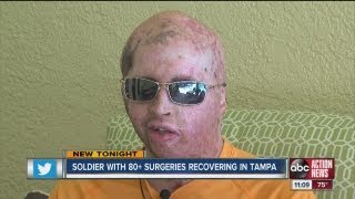 Second most wounded Iraq soldier recovering in Tampa [upl. by Miarhpe]