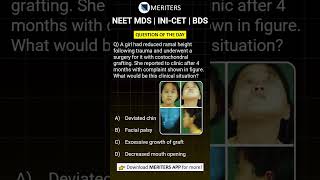 NEET MDS  INICET MDS  PSC  BDS  Most Important Questions neetmds2025 mdsprep [upl. by Zuckerman973]