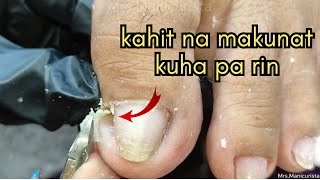 Vlog 930Dry SkinIngrown Removal PEDICURE 830 [upl. by Terrene528]