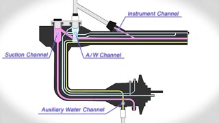 OERPro Uses Connector Overflow System [upl. by Eille]