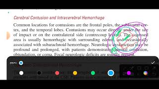 chapter 160 tintinalli emergency medicine head trauma [upl. by Ellenor]