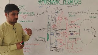 overview of hemodynamic disorders in hindi  hemorrhageshock infarction edema etc  by Dr aqib [upl. by Evod]