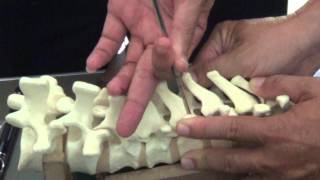 APSS Workshop Video 2 Thoracic Pedicle Screw [upl. by Nalehp]