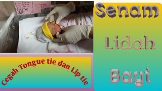 Senam lidah bayi cegah tongue tie dan lip tie  agar bayi lancar menyusui [upl. by Kerk]