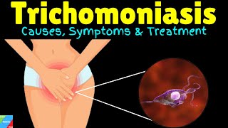 Trichomoniasis Causes Symptoms Diagnosis Treatments and prevention [upl. by Carma]