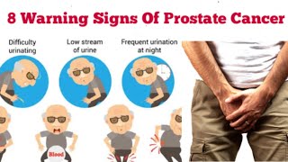 8 Signs That You Have Prostate Cancer Symptoms Prostate Cancer in Males [upl. by Akyssej979]