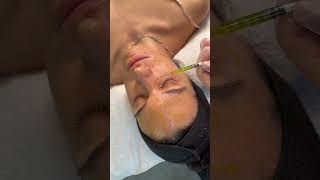 BioRePeel Peeling Mit Liebe zum Detail Kosmetiksalon 🌿 skincare shortsvideo biorepeel [upl. by Manvel]