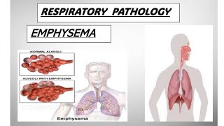 Respo pathology  COPD  EMPHYSEMA copd emphysema pathology [upl. by Ajtak]