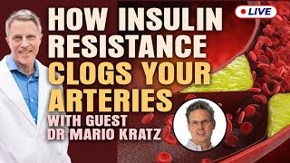 Dr Mario Kratz This Is How Insulin Resistance Clogged Arteries [upl. by Akissej370]