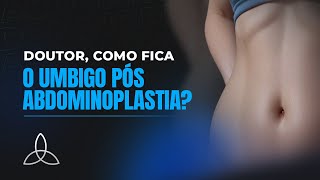 O Umbigo Pós Abdominoplastia  Dr Antônio Marcos [upl. by Clawson]