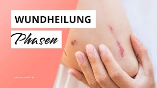 Wundheilungsphasen So läuft die Wundheilung ab [upl. by Greeley]