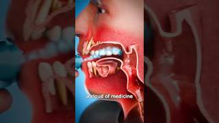 How An Inhaler Works 🤔viral shorts ‎drMaryamGull [upl. by Attenat571]