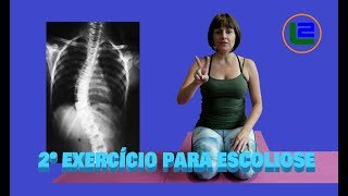 ESCOLIOSE  EXERCÍCIOS SIMPLES QUE FUNCIONAM  PARTE 2 [upl. by Gavra]