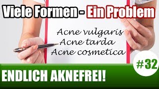 Akne vulgaris Akne conglobata amp Co  Viele Akneformen  Ein Problem ENDLICH AKNEFREI 32 [upl. by Nimref446]