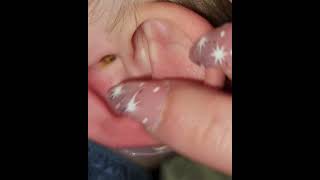 Ear cleaning Ear wax cleaning  satisfying diy treanding [upl. by Libbie]