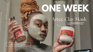 This Mask Brought My Face To Life  Bentonite Clay [upl. by Mosa]