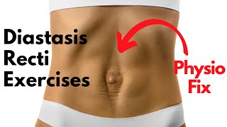 How to START Diastasis Recti Exercises that FIX YOUR GAP  PHYSIO GUIDED Abdo Separation Repair [upl. by Ajiak]