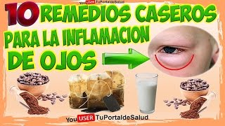 Como Curar la Inflamación de Ojos o Blefaritis con 10 Remedios Caseros [upl. by Formenti]