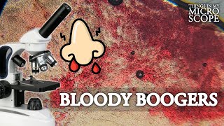 BLOODY BOOGER UNDER MICROSCOPE  100X 250X 4K [upl. by Lener726]