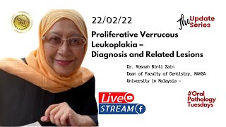 Oral Pathology Proliferative verrucous Leukoplakia – Issues in Diagnosis and its Related Lesions [upl. by Concha80]