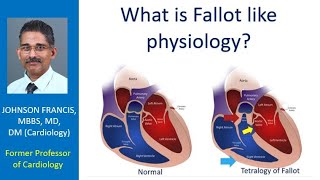 What is Fallot like physiology [upl. by Alael]