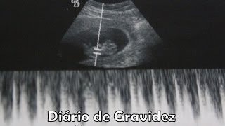 Diário de gravidez  11 semanas  Semana de ultra ♥ Por Eláyne Oliveira [upl. by Kan]