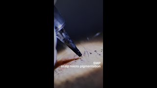 Scalp Micro Pigmentation SMP Non Permanent Tattoo Artificial Hair [upl. by Eveneg720]