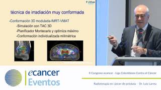 Radioterapia en cáncer de próstata [upl. by Tri]