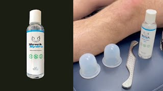 Runners Knee Pain Relief IASTM Cupping amp Taping with HawkHydro [upl. by Anaidirib]