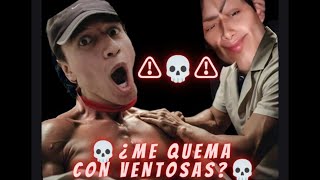 ⚠️🔥¿QUEMARÉ a mi COMPA Usando VENTOSAS por PRIMERA VEZ en ESPALDA 🔥⚠️ [upl. by Tristas]