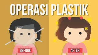 Apakah Operasi Plastik Pakai “Plastik” [upl. by Niatirb]