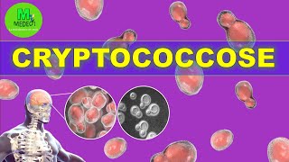 CRYPTOCOCCOSE  cours de mycologie médicale [upl. by Howell470]