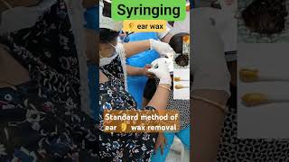 SYRINGING IRRIGATION OF EAR CANAL A STANDARD METHOD OF EARWAXREMOVALearcleaningviralvideoyoutube [upl. by Teragramyram]