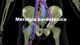 Meralgia Parestésica [upl. by Enialem633]