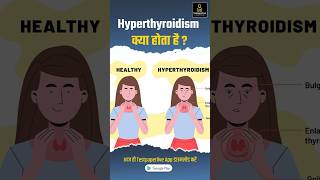 Hyperthyroidism Overview hyperthyroidism Hyperthyroidismdisease testpaperlive [upl. by Josselyn]