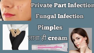 Fungal Infection Pimples Nadibact Plus Cream Information In MarathiPrivate Part Infection [upl. by Bland231]