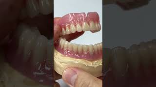 Characteristics denture with two implants [upl. by Retxed]