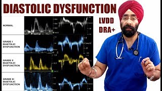 Rx Heart 19 Eng Diastolic Dysfunction  LVDD  Diastolic Heart Failure  DRA ENG DrEducation [upl. by Haya806]