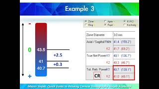 A Quick Guide to Reading Corneal Tomography Part 4 [upl. by Oliva]