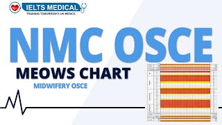 NMC OSCE MEOWS CHARTS For Midwives  Modified Early Obstetric Warning Score Explained  How to Chart [upl. by Dominic831]