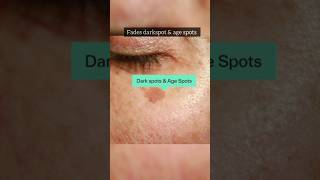 DERMATOUCH Bye Bye Pigmentation Cream reviewdarkspotsdermocosmeticspigmentationhyperpigmentation [upl. by Segal]